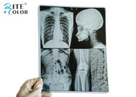 Mürekkep Püskürtmeli Yazıcılar için 10 * 12 İnç PET Tıbbi Görüntüleme Filmi Kuru X Ray Filmi