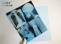 Mürekkep Püskürtmeli Mavi Radyoloji Tıbbi Görüntüleme Filmi
