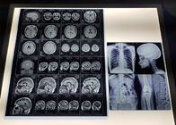 Su geçirmez 215 Mikron PET Esaslı Medikal X Ray Filmi
