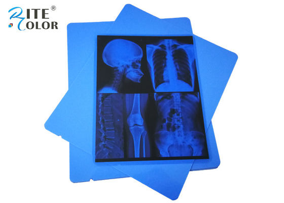 13 X 17 İnç Tıbbi Görüntüleme Filmi PET Mavi Mürekkep Püskürtmeli Xray Radyoloji