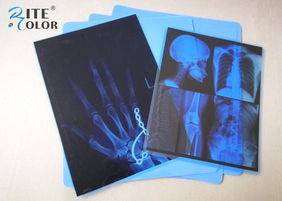 Epson Yazıcı için Düşük Sisli Mavi PET Mürekkep Püskürtmeli Tıbbi Görüntüleme Filmi 8 x 10 İnç