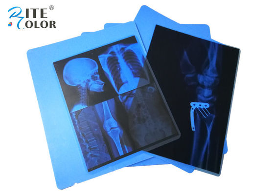 Canon Pixma Yazıcılar İçin Mürekkep Püskürtmeli PET Tıbbi Görüntüleme Mavi X Ray Filmi