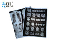 PET Taban X Ray Levha Filmi Radyoloji Görüntüleme Filmi Paket Başına DR CT 100 Yaprak