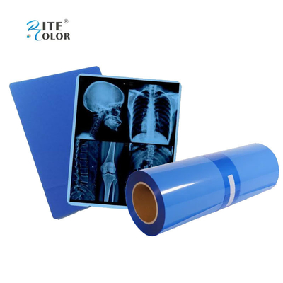 IMATEC Mavi PET Mürekkep Atışlı Tıbbi CR X-Ray Radyografi Filmi Canon Yazıcıları İçin