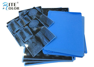11 X 14 Inç Lazer Görüntüleme Filmi A4 PET Mürekkep Püskürtmeli Tıbbi Kuru X Ray Film Için CT CR MRT
