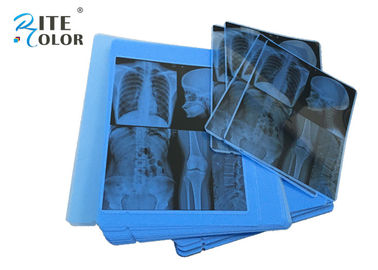 Epson Mürekkep Püskürtmeli Yazıcı için Radyoloji Mavi X Ray Tıbbi Görüntüleme Filmi 210um Kalınlığı