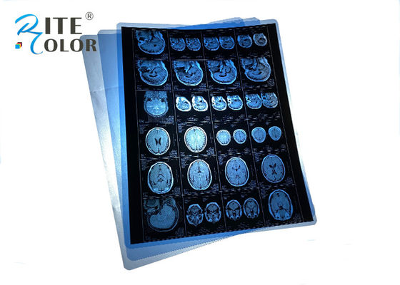 Su geçirmez PET MRT CT CR Dental panorama görüntüleri çıkışı için Mavi Tıbbi X-ışını filmi